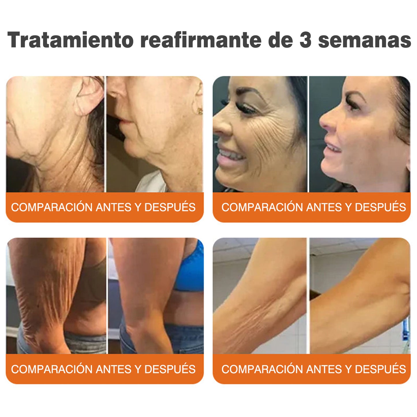 ✅Fabricado y enviado desde el Reino Unido 🇪🇸 Rolimey® Stick Serum Reafirmante con Veneno de Abeja tipo Botox (⏳¡ÚLTIMO DÍA! 70% DE DESCUENTO)🛫