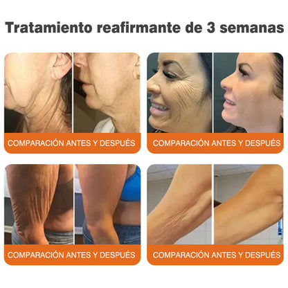 ✅Fabricado y enviado desde el Reino Unido 🇪🇸 Rolimey® Stick Serum Reafirmante con Veneno de Abeja tipo Botox (⏳¡ÚLTIMO DÍA! 70% DE DESCUENTO)🛫