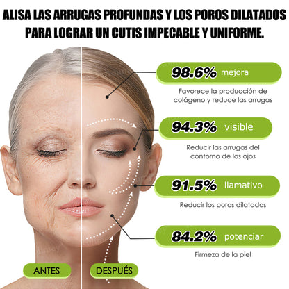Fabricado y enviado desde España 💥Rolimey® Botox & Vita-A Retinol Shot Crema reafirmante y lifting antiarrugas - Promoción de último día 70% de descuento