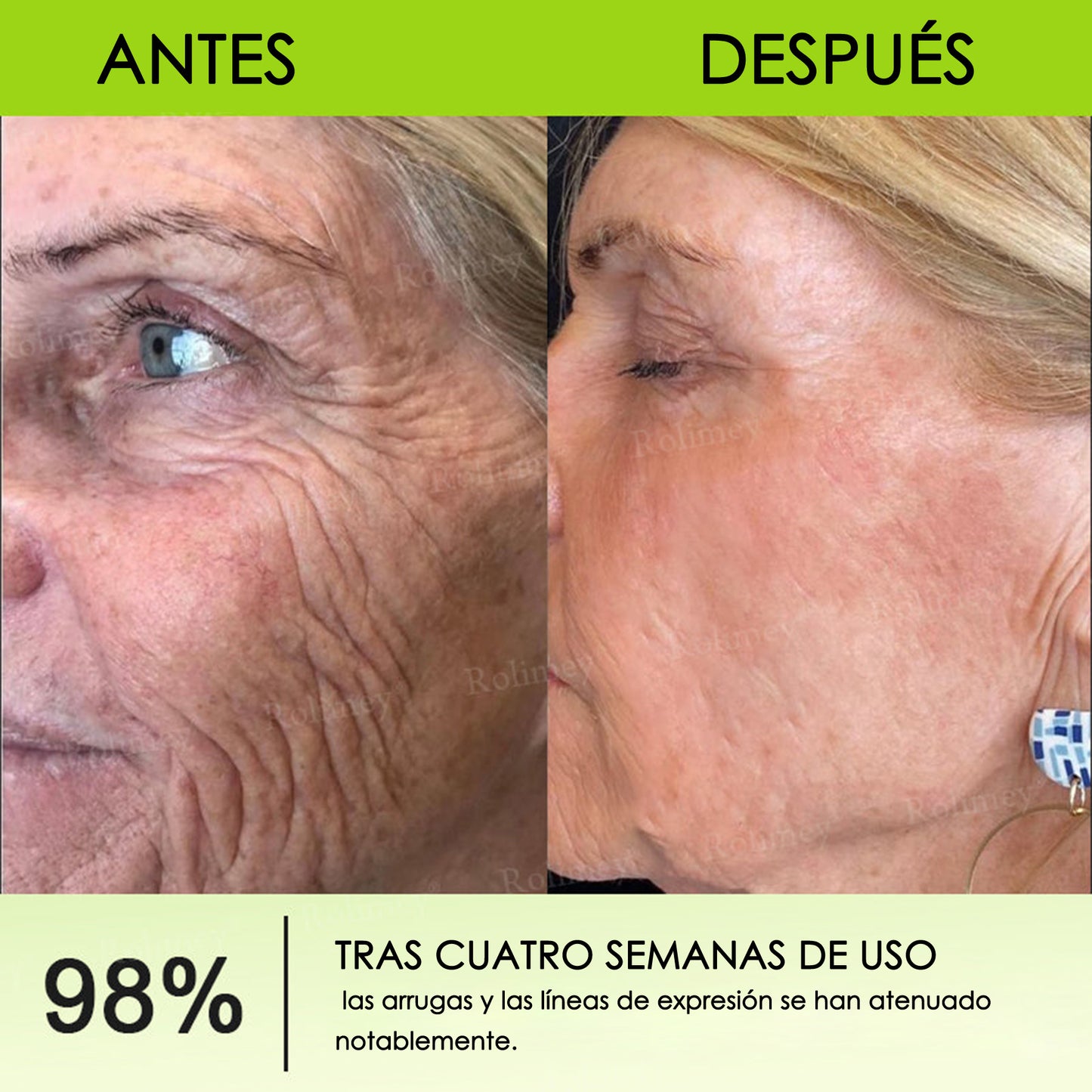 Fabricado y enviado desde España 💥Rolimey® Botox & Vita-A Retinol Shot Crema reafirmante y lifting antiarrugas - Promoción de último día 70% de descuento