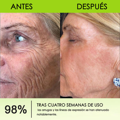 Fabricado y enviado desde España 💥Rolimey® Botox & Vita-A Retinol Shot Crema reafirmante y lifting antiarrugas - Promoción de último día 70% de descuento
