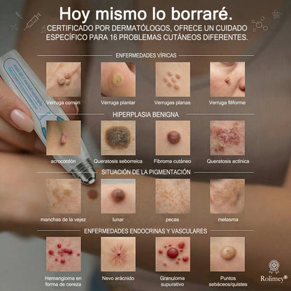 Rolimey® Borrador de marcas y manchas en 7 días (Roll-on sin dolor y sin cicatrices)✅ Apto para: acrocordones, manchas, lunares, verrugas, ampollas, eccema, caspa, queratosis, acné, crecimientos cutáneos, cicatrices, marcas de nacimiento👩‍⚕️