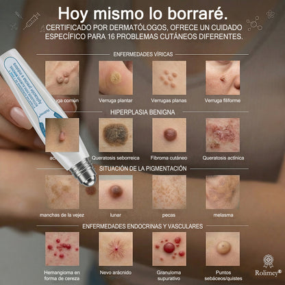 Rolimey® 🌿Borrador de Verrugas y Manchas en 7 Días (𝐀𝐩𝐥𝐢𝐜𝐚𝐝𝐨𝐫 𝐫𝐨𝐥𝐥-𝐨𝐧: 𝐬𝐢𝐧 𝐝𝐨𝐥𝐨𝐫 𝐧𝐢 𝐜𝐢𝐜𝐚𝐭𝐫𝐢𝐜𝐞𝐬)