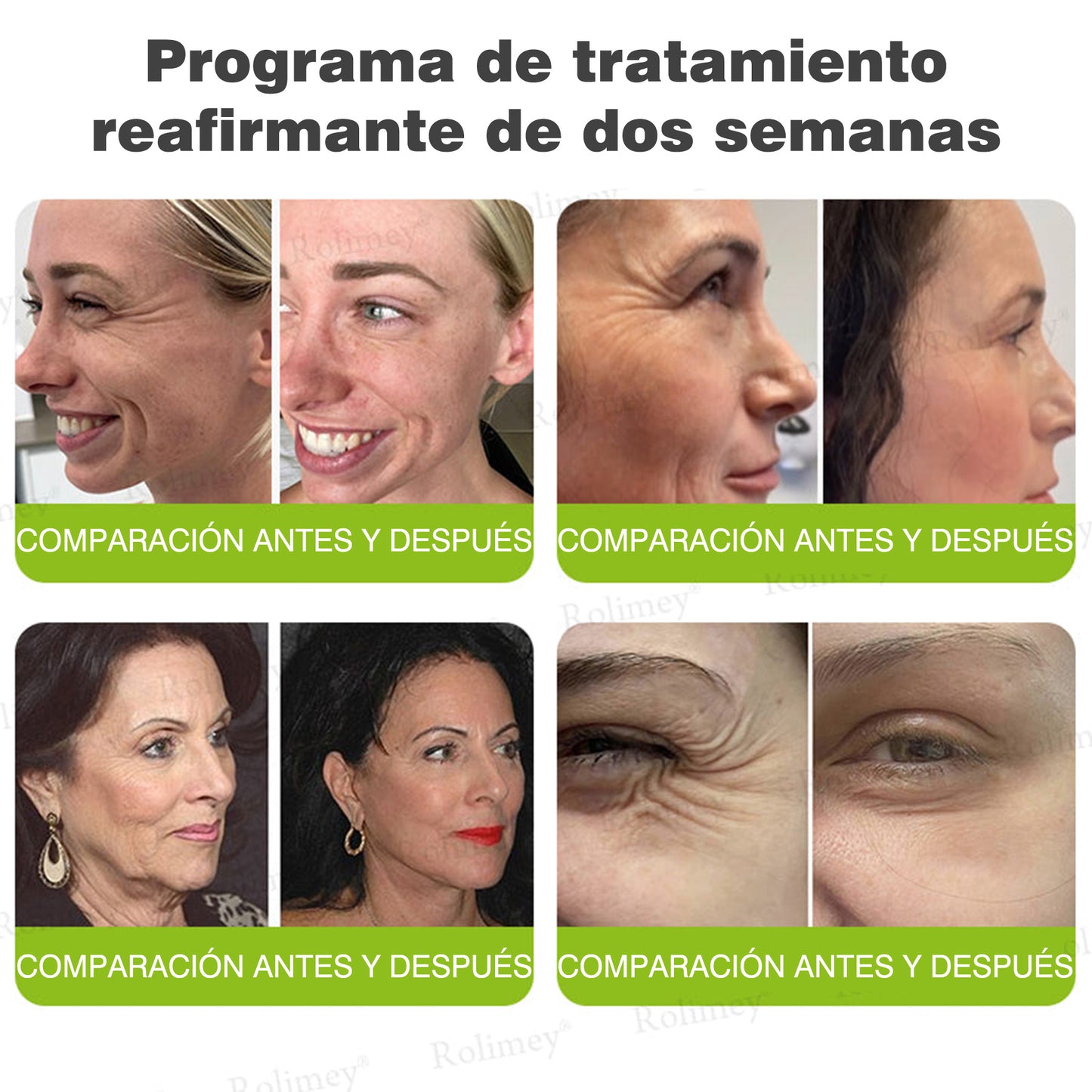 Fabricado y enviado desde España 💥Rolimey® Botox & Vita-A Retinol Shot Crema reafirmante y lifting antiarrugas - Promoción de último día 70% de descuento