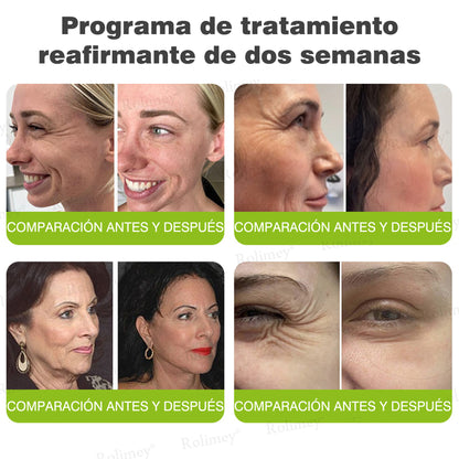 Fabricado y enviado desde España 💥Rolimey® Botox & Vita-A Retinol Shot Crema reafirmante y lifting antiarrugas - Promoción de último día 70% de descuento