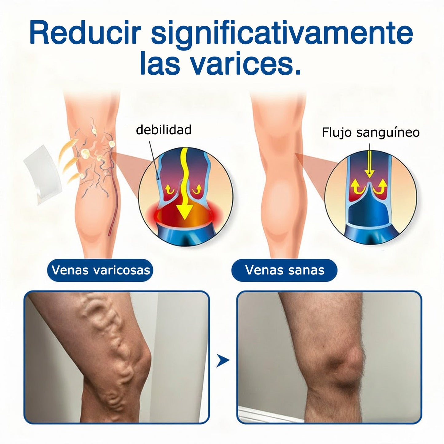 🇪🇸🤍✅Parche de microagujas GFOUK® VeinEase para el cuidado de las venas⚡Alivio instantáneo, resultados a largo plazo
