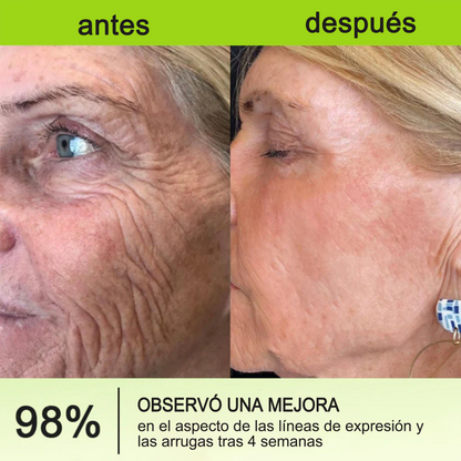 🎁 Dr. Fachmer® 👩‍⚕️ Péptidos y colágeno con efecto tensor inmediato: ayuda a reducir la apariencia de bolsas y líneas de expresión, dejando la piel con un aspecto más firme y terso. ✨