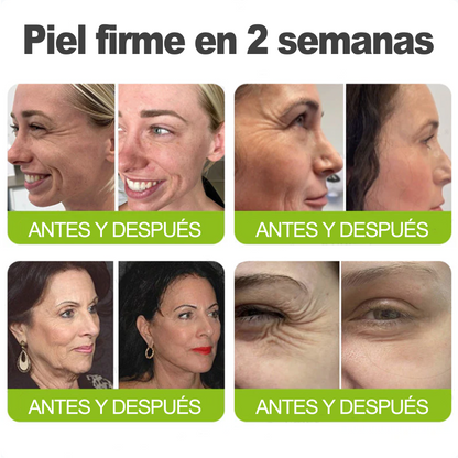 🎁 Dr. Fachmer® 👩‍⚕️ Péptidos y colágeno con efecto tensor inmediato: ayuda a reducir la apariencia de bolsas y líneas de expresión, dejando la piel con un aspecto más firme y terso. ✨