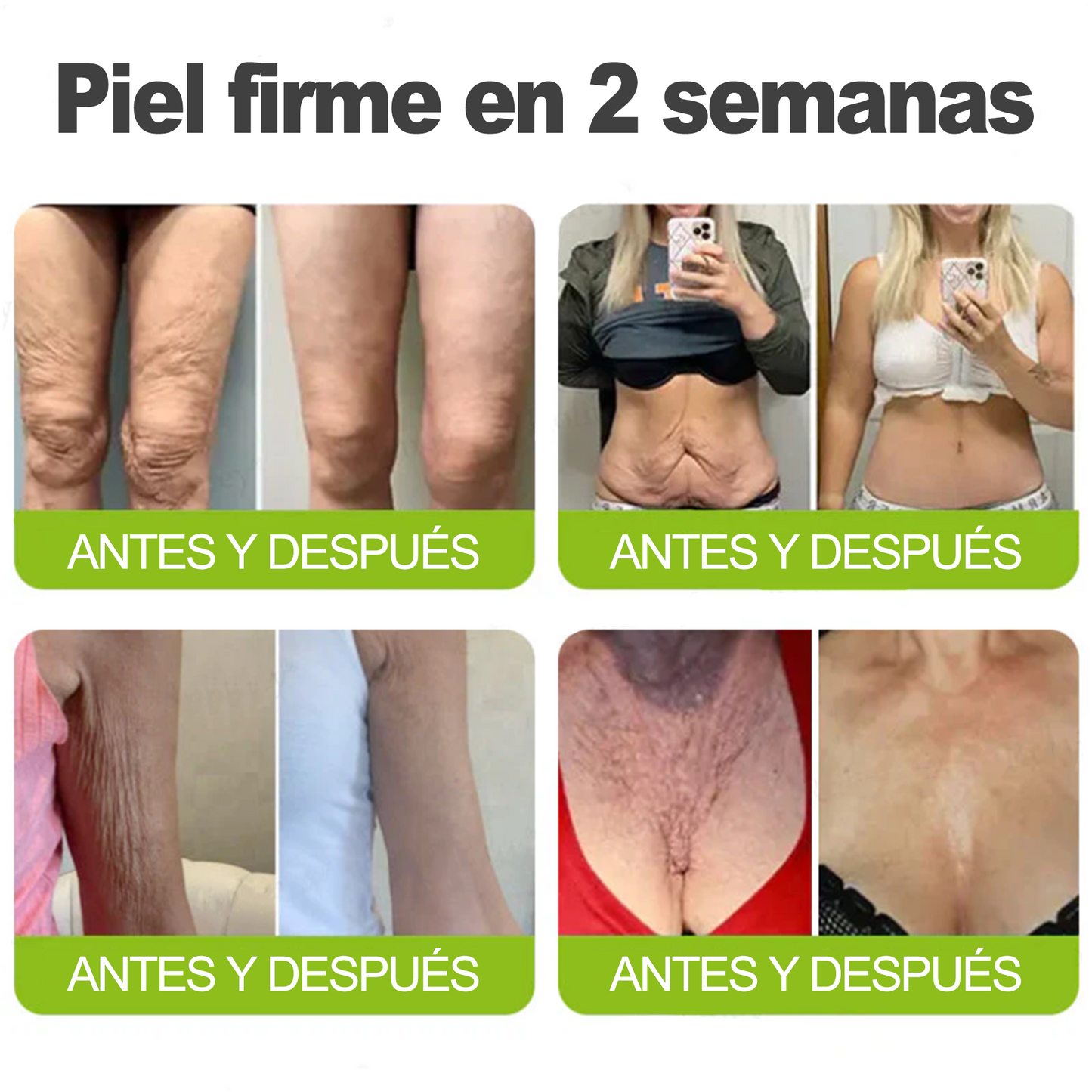 🎁 Dr. Fachmer® 👩‍⚕️ Péptidos y colágeno con efecto tensor inmediato: ayuda a reducir la apariencia de bolsas y líneas de expresión, dejando la piel con un aspecto más firme y terso. ✨