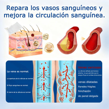 🇪🇸🤍✅Parche de microagujas GFOUK® VeinEase para el cuidado de las venas⚡Alivio instantáneo, resultados a largo plazo