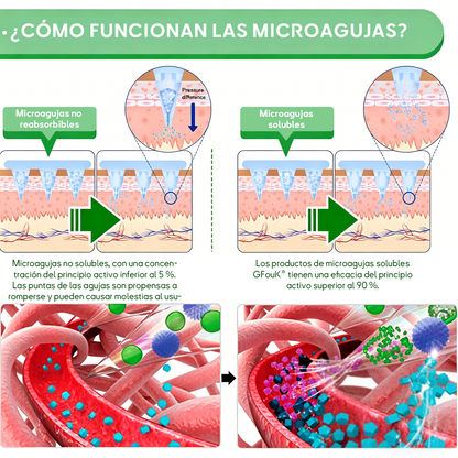 Nueva actualización 2026: 𝑮𝑭𝑶𝑼𝑲® 𝑩𝒆𝒓𝑏𝘦𝘳𝑖𝗇𝒆 𝟲-𝗶𝙣-𝟏 𝑁𝑎𝑛𝑜 𝘔𝘪𝘤𝘳𝘰𝘯𝘦𝘦𝘥𝘭𝘦 𝖯𝚊𝗍𝖼𝗁 con fórmula respaldada por la ciencia.