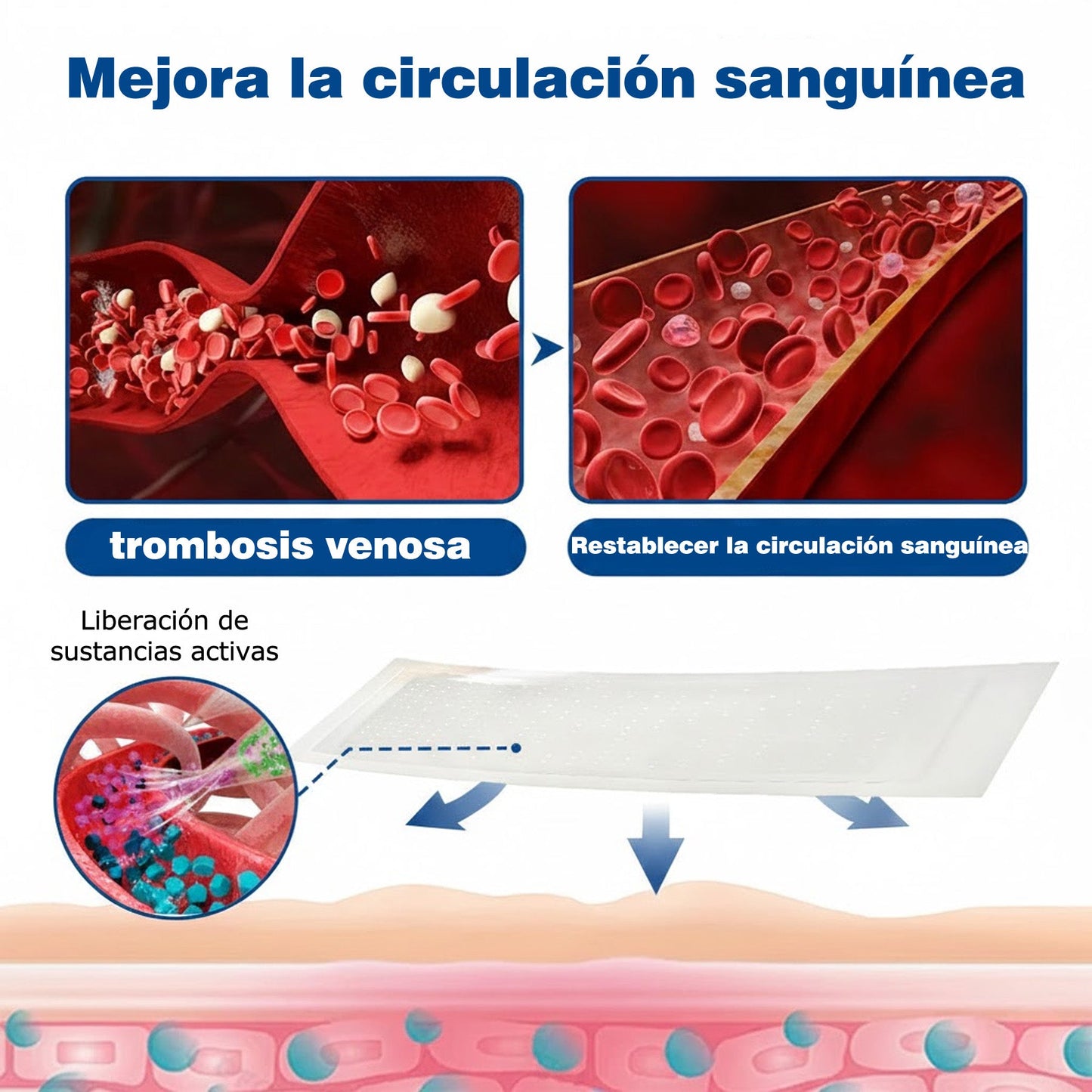 🇪🇸🤍✅Parche de microagujas GFOUK® VeinEase para el cuidado de las venas⚡Alivio instantáneo, resultados a largo plazo