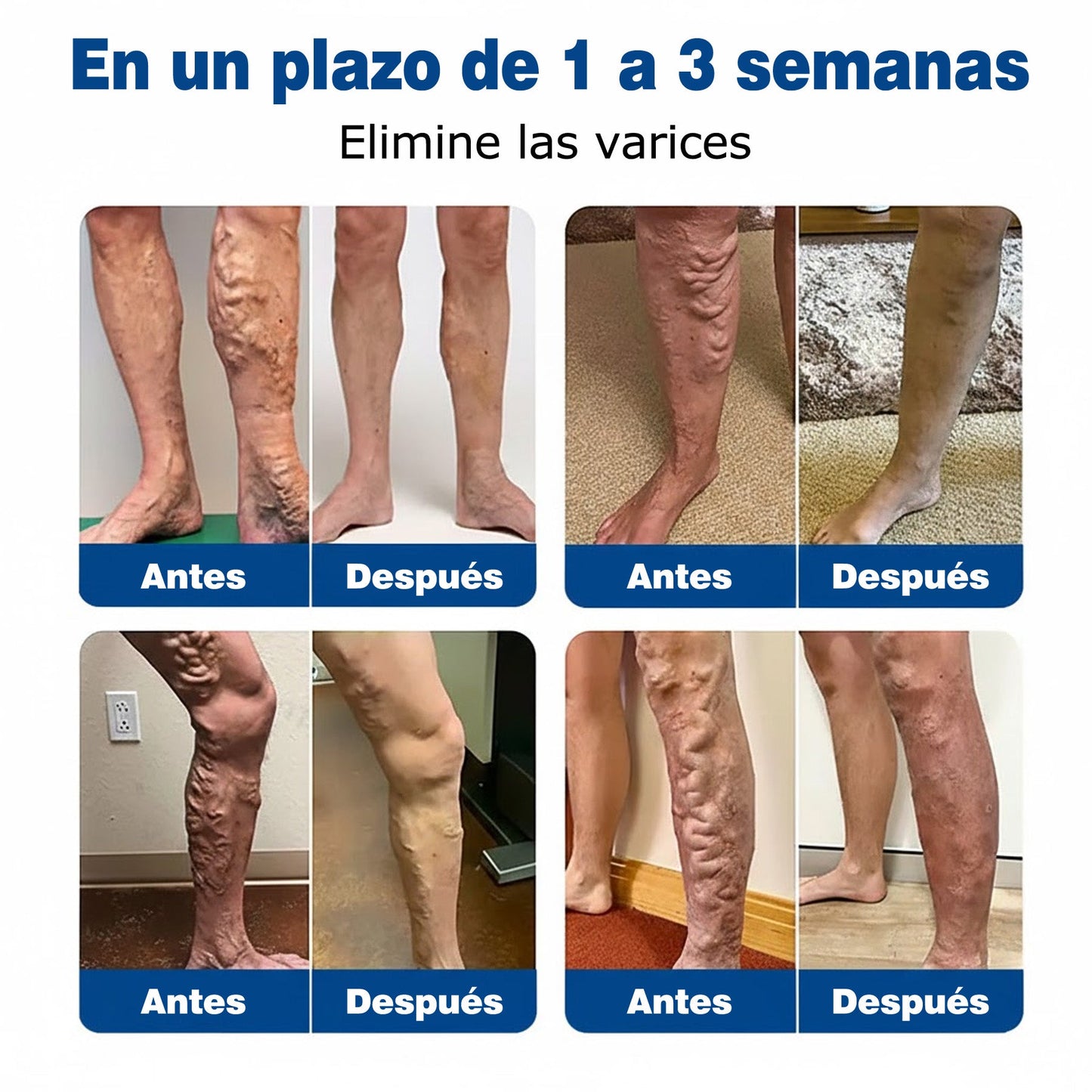 🇪🇸🤍✅Parche de microagujas GFOUK® VeinEase para el cuidado de las venas⚡Alivio instantáneo, resultados a largo plazo