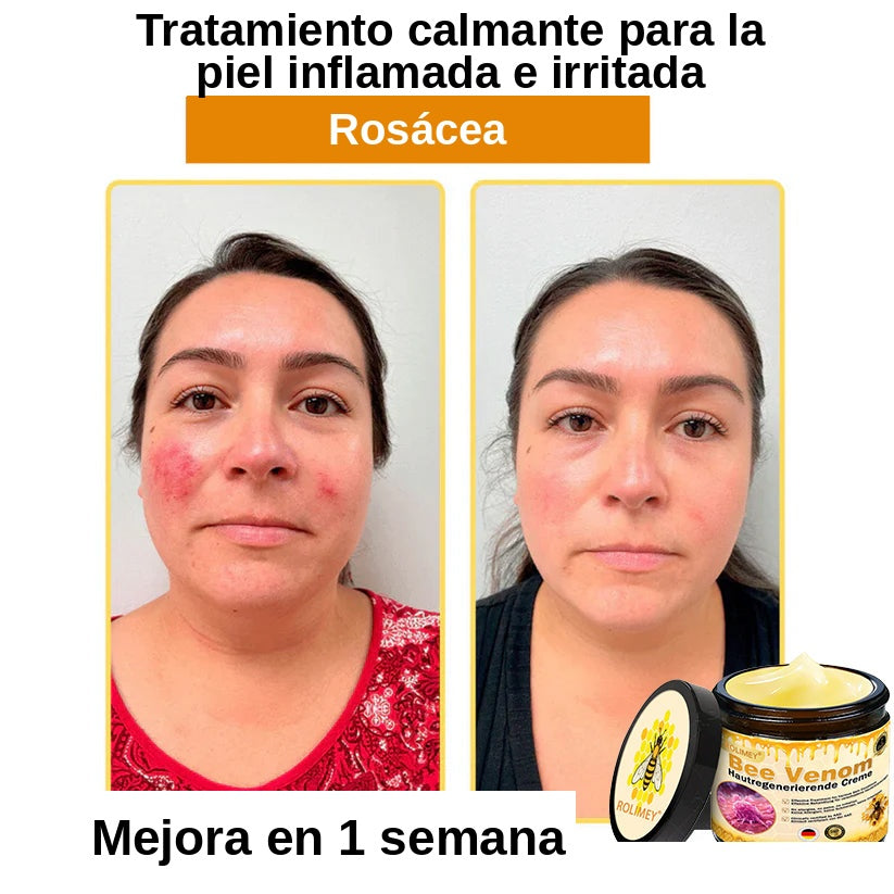 ❄️ Crema completa Rolimey® Bienengift Pro — 🔥¡80 % de DESCUENTO por tiempo limitado!🔥
