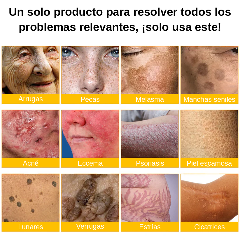 ❄️ Crema completa Rolimey® Bienengift Pro — 🔥¡80 % de DESCUENTO por tiempo limitado!🔥