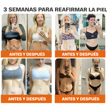 ❄️ Crema completa Rolimey® Bienengift Pro — 🔥¡80 % de DESCUENTO por tiempo limitado!🔥