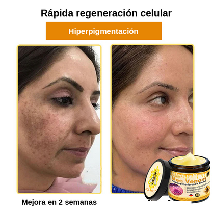 ❄️ Crema completa Rolimey® Bienengift Pro — 🔥¡80 % de DESCUENTO por tiempo limitado!🔥
