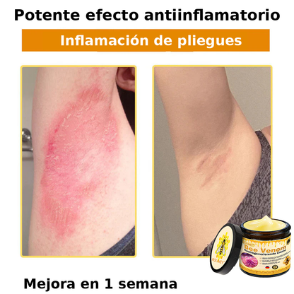❄️ Crema completa Rolimey® Bienengift Pro — 🔥¡80 % de DESCUENTO por tiempo limitado!🔥