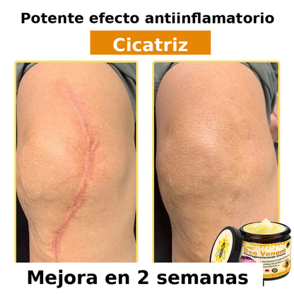 ❄️ Crema completa Rolimey® Bienengift Pro — 🔥¡80 % de DESCUENTO por tiempo limitado!🔥