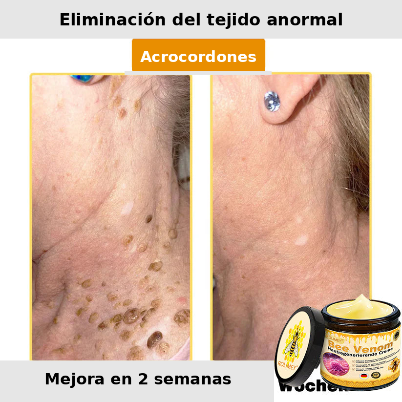 ❄️ Crema completa Rolimey® Bienengift Pro — 🔥¡80 % de DESCUENTO por tiempo limitado!🔥