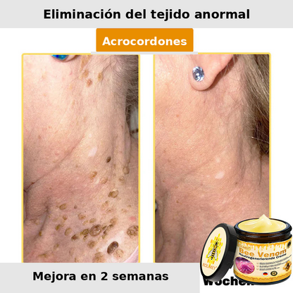 ❄️ Crema completa Rolimey® Bienengift Pro — 🔥¡80 % de DESCUENTO por tiempo limitado!🔥