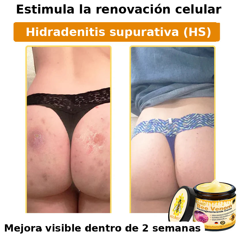 ❄️ Crema completa Rolimey® Bienengift Pro — 🔥¡80 % de DESCUENTO por tiempo limitado!🔥