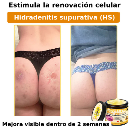 ❄️ Crema completa Rolimey® Bienengift Pro — 🔥¡80 % de DESCUENTO por tiempo limitado!🔥