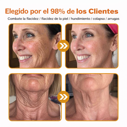 ❄️ Crema completa Rolimey® Bienengift Pro — 🔥¡80 % de DESCUENTO por tiempo limitado!🔥