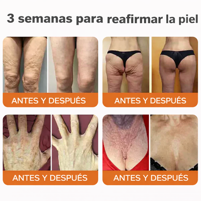 ❄️ Crema completa Rolimey® Bienengift Pro — 🔥¡80 % de DESCUENTO por tiempo limitado!🔥
