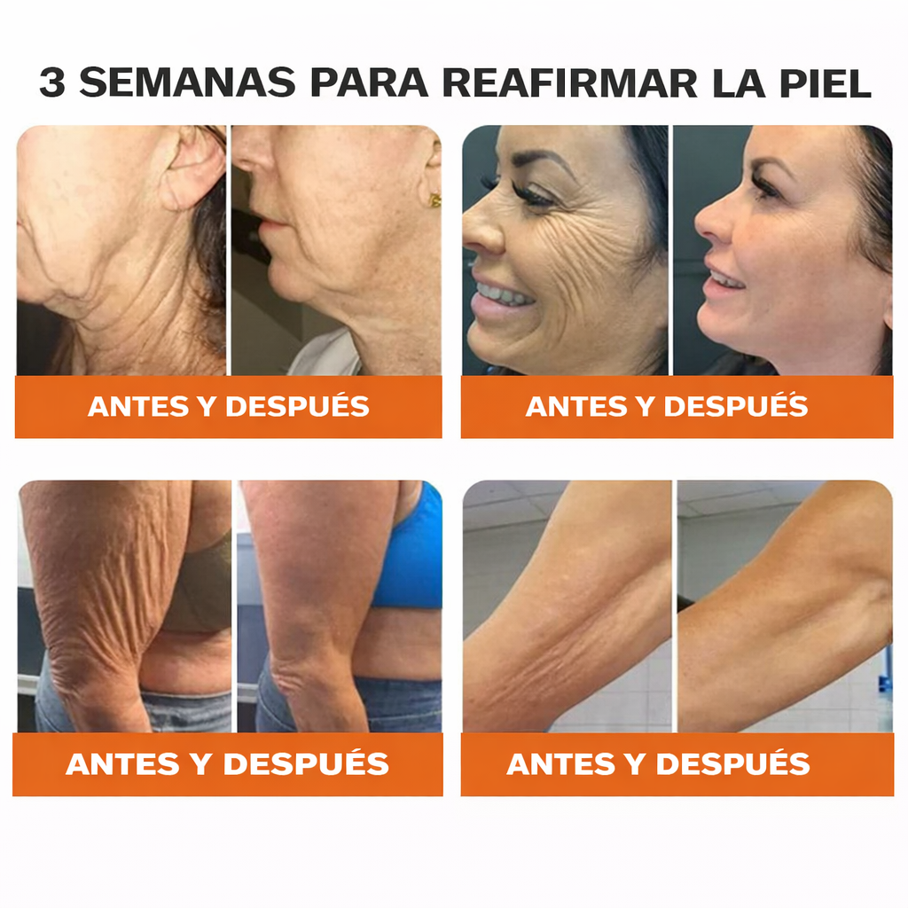 ❄️ Crema completa Rolimey® Bienengift Pro — 🔥¡80 % de DESCUENTO por tiempo limitado!🔥