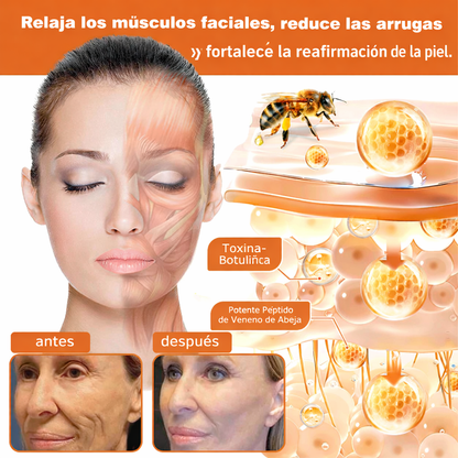 ❄️ Crema completa Rolimey® Bienengift Pro — 🔥¡80 % de DESCUENTO por tiempo limitado!🔥
