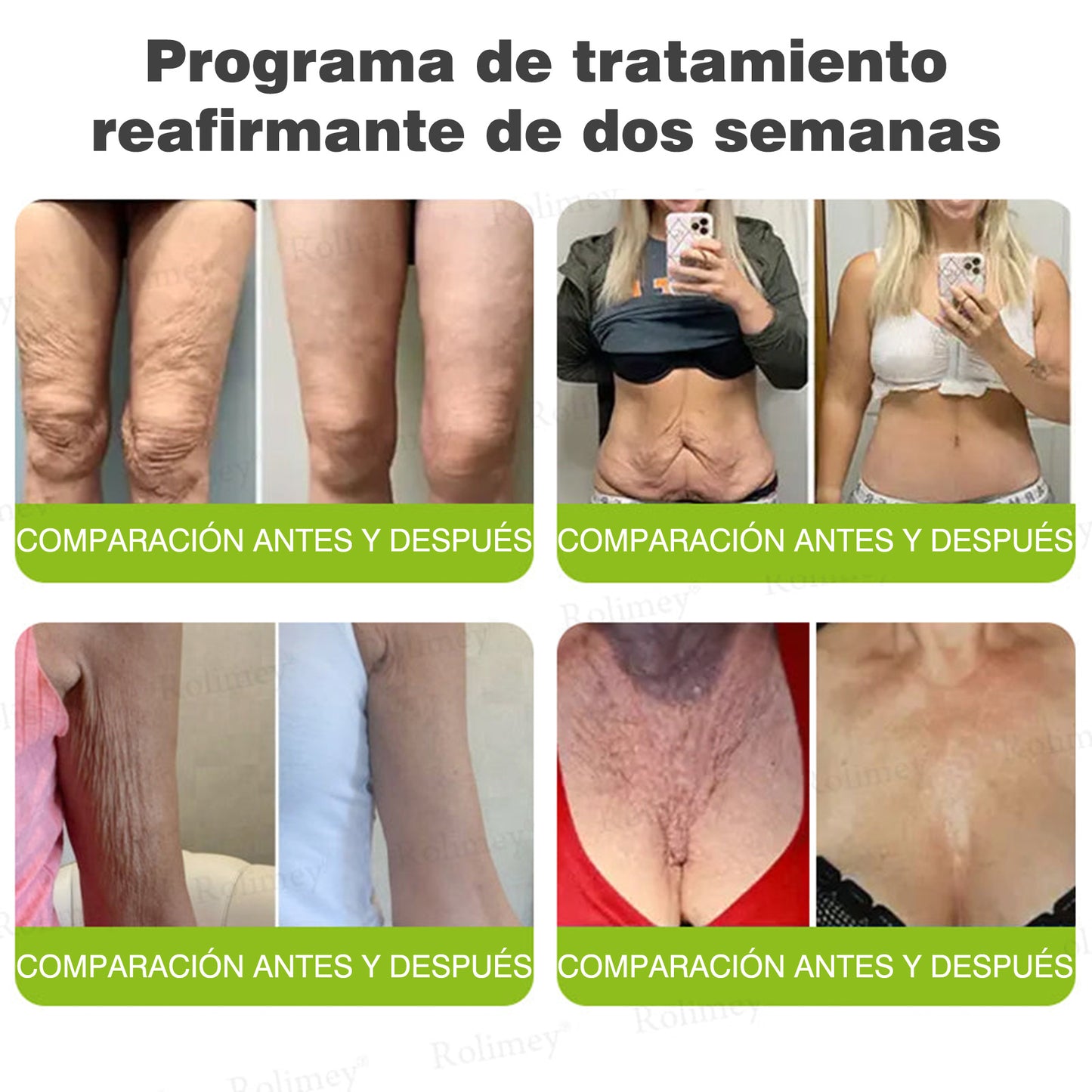 Fabricado y enviado desde España 💥Rolimey® Botox & Vita-A Retinol Shot Crema reafirmante y lifting antiarrugas - Promoción de último día 70% de descuento