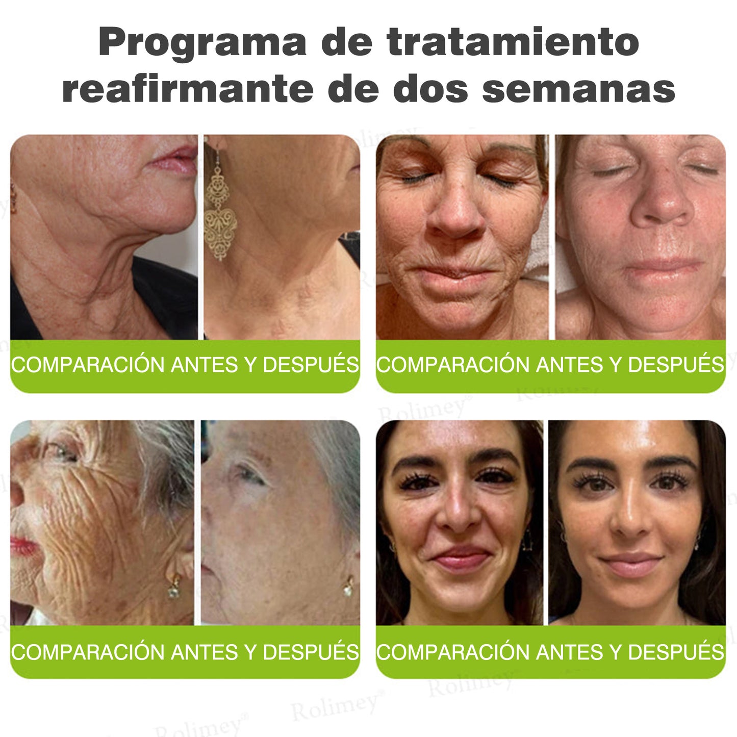 Fabricado y enviado desde España 💥Rolimey® Botox & Vita-A Retinol Shot Crema reafirmante y lifting antiarrugas - Promoción de último día 70% de descuento