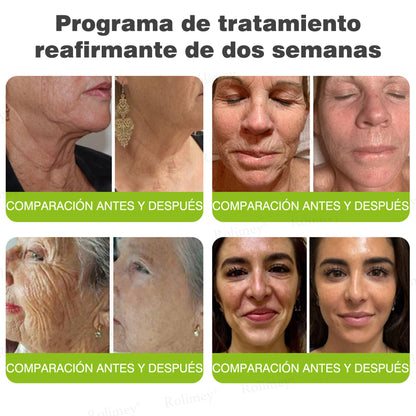Fabricado y enviado desde España 💥Rolimey® Botox & Vita-A Retinol Shot Crema reafirmante y lifting antiarrugas - Promoción de último día 70% de descuento