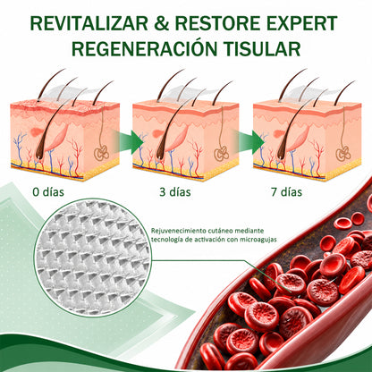 🇪🇸👨‍⚕️ DR.Fachmer® 💚 Parche de Microneedles Vein Ease (Para arañas vasculares, varices, hinchazón y piernas cansadas)