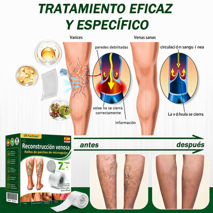 🇪🇸👨‍⚕️ DR.Fachmer® 💚 Parche de Microneedles Vein Ease (Para arañas vasculares, varices, hinchazón y piernas cansadas)