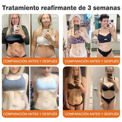 ✅Fabricado y enviado desde el Reino Unido 🇪🇸 Rolimey® Stick Serum Reafirmante con Veneno de Abeja tipo Botox (⏳¡ÚLTIMO DÍA! 70% DE DESCUENTO)🛫