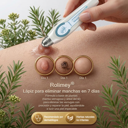 Rolimey® Borrador de marcas y manchas en 7 días (Roll-on sin dolor y sin cicatrices)✅ Apto para: acrocordones, manchas, lunares, verrugas, ampollas, eccema, caspa, queratosis, acné, crecimientos cutáneos, cicatrices, marcas de nacimiento👩‍⚕️