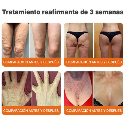 ✅Fabricado y enviado desde el Reino Unido 🇪🇸 Rolimey® Stick Serum Reafirmante con Veneno de Abeja tipo Botox (⏳¡ÚLTIMO DÍA! 70% DE DESCUENTO)🛫